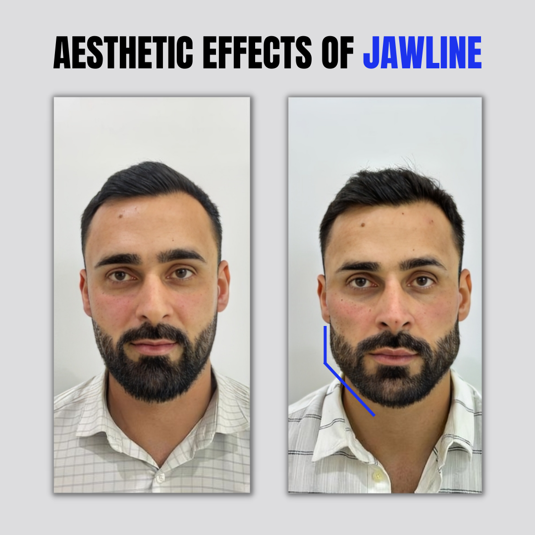 The Secret To The Jawline You’ve Always Wanted